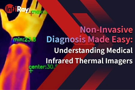Diagnóstico no invasivo fácil: comprensión de las imágenes térmicas infrarrojas médicas